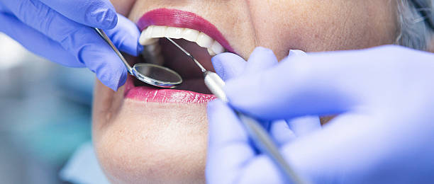 Best Emergency Dental Extractions in Coto De Za, CA