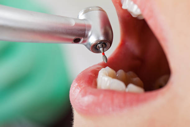 Best Urgent Dental Care for Toothache in Coto De Za, CA